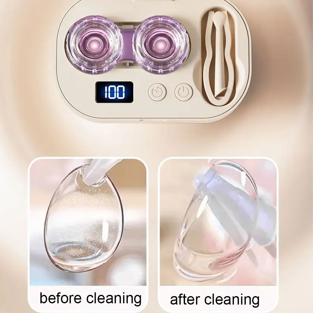 view